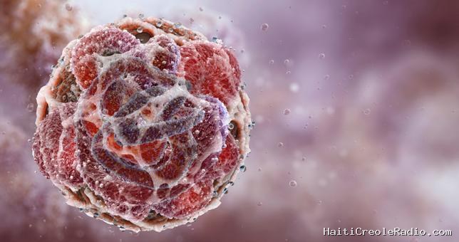 Cancer du pancréas, percée de la Chine… Les temps forts du congrès américain sur le cancer