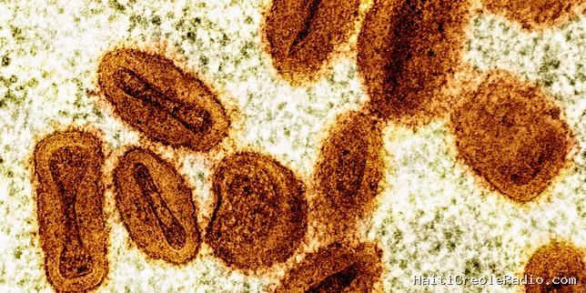 Deux virologues inculpés aux Etats-Unis pour avoir tenté d’importer le virus monkeypox d’Afrique