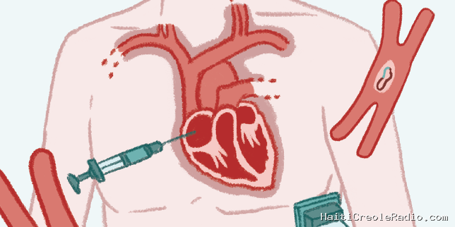 Un pacemaker externe qui régule les anomalies du rythme cardiaque grâce aux ultrasons