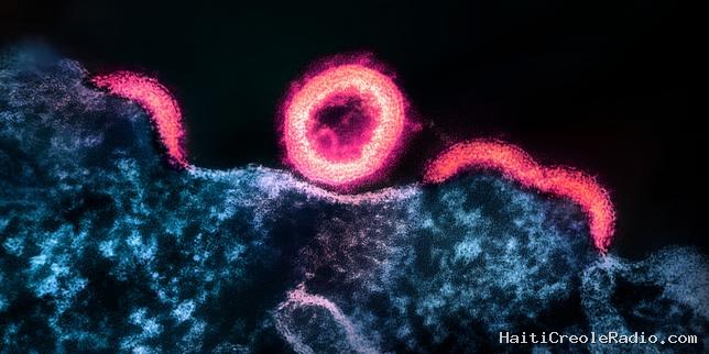 VIH : découverte de nouvelles cellules réservoirs, où le virus se réfugie et échappe aux traitements